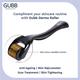 Gubb Derma Roller 540 Needles 0.5mm - Golden 1's - Derma Rollers