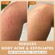 MCaffeine 7% Exfoliating Body Wash- 1% Salicylic 2% Lactic Acid, Shower Gel to Reduce Body Acne 300 ml - Shower Gels & Body Wash