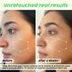 Plix The Plant Fix 25% Aha + 2% Bha + 5% Pha Peeling Solution For Glowing 30 ml - Face Gels