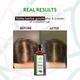 Nature Spell Rosemary With Jamaican Black Castor Oil For Hair & Skin 150 ml - Hair Oils