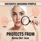 Urban Yog Acne Pimple Patch 72 Invisible Facial Stickers 1's - Masks & Peels
