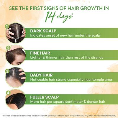 WOW Skin Science Rosemary with Biotin Hair Growth Oil 200 ml - Hair Oils
