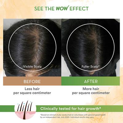 WOW Skin Science Rosemary with Biotin Hair Growth Oil 200 ml - Hair Oils