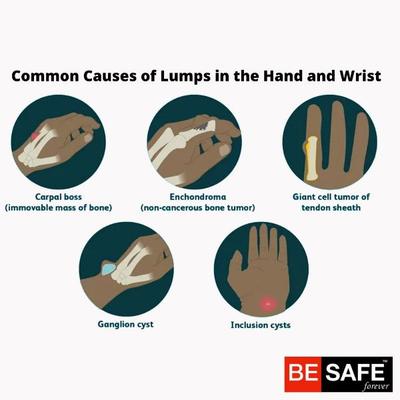 Be Safe Forever Wristband - Black - Knee/Ankle/Leg/Foot Supports