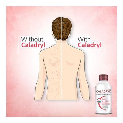 Caladryl Lotion 60 ml - Skin-Treatment