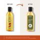 Jiva Ayurveda Medicated Til Oil 120 ml - Speciality Medicines