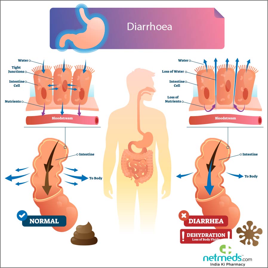 diarrhoea
