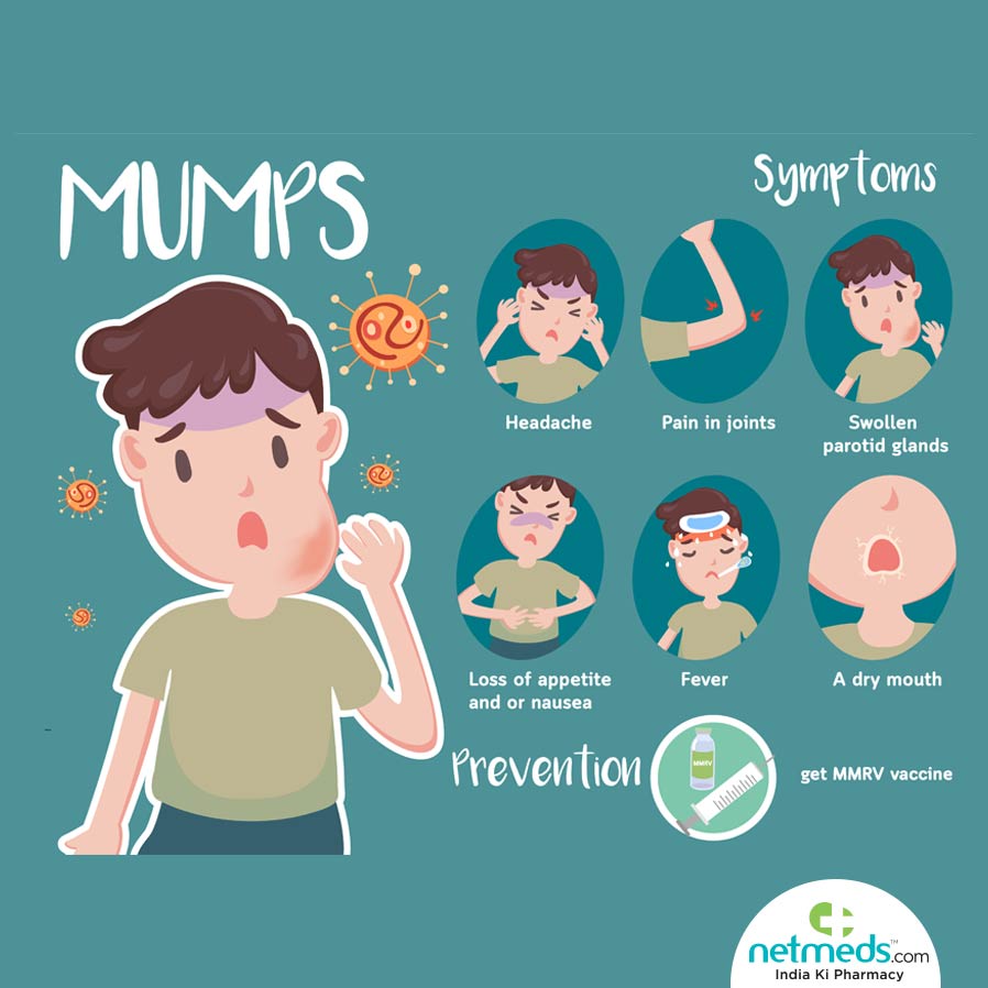 mumps symptoms