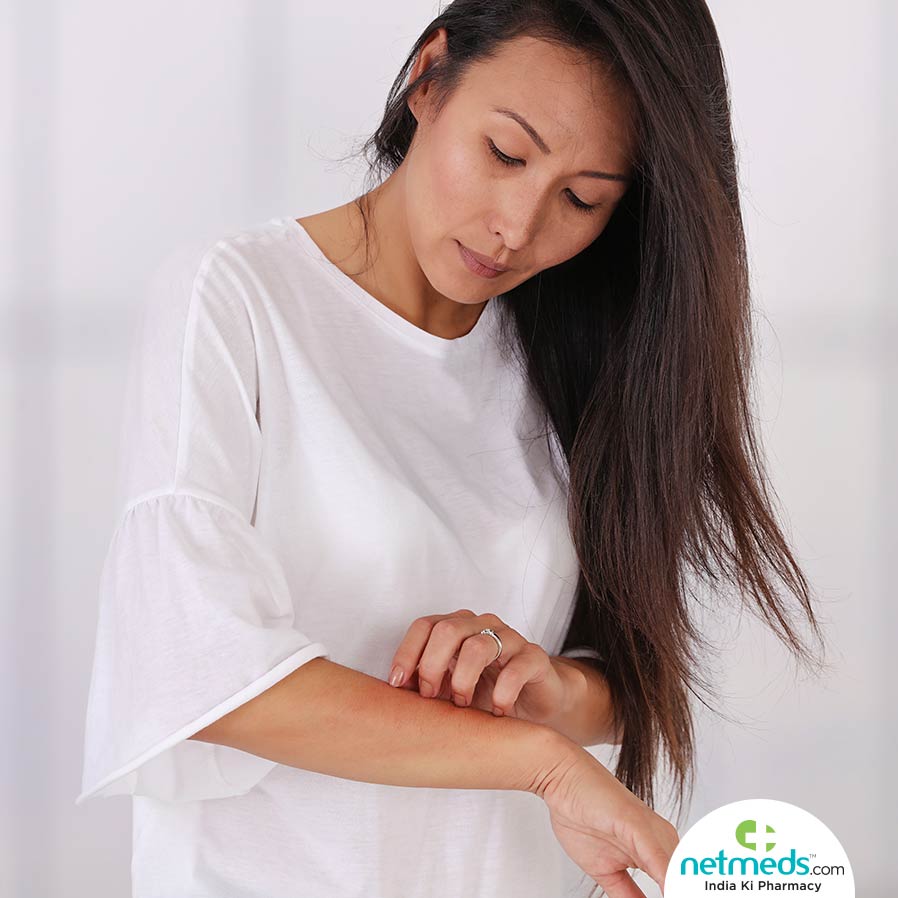 Polymorphous Light Eruption