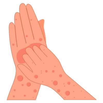 Post Prandial Blood Sugar(Ppbs) - Diabetes Care
