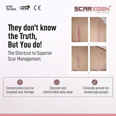 Scarxgen Silicone Gel Sheet (3 cm X 15 cm) 1's - Bandages