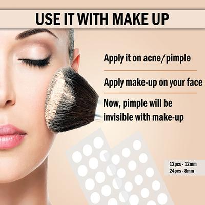 Urbangabru Yog Acne Pimple Patch 72 Invisible Facial Stickers 1's - Masks & Peels