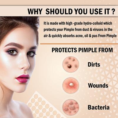 Urbangabru Yog Acne Pimple Patch 72 Invisible Facial Stickers 1's - Masks & Peels