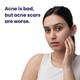 Reequil Pitstop Blue Niacinamide Serum For Acne Scars & Marks 25 ml - Face Gels